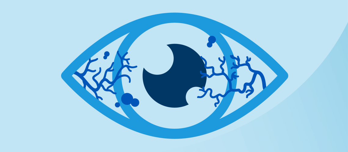 Diabetic Retinopathy